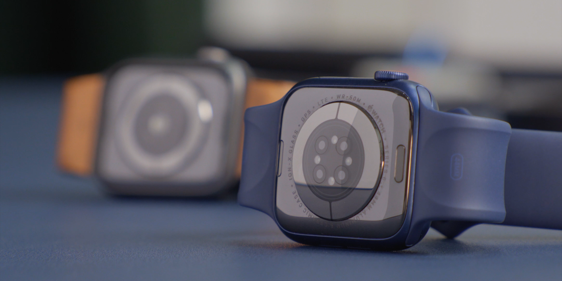 会宁苹果手机维修分享Apple Watch 是如何测量卡路里的 